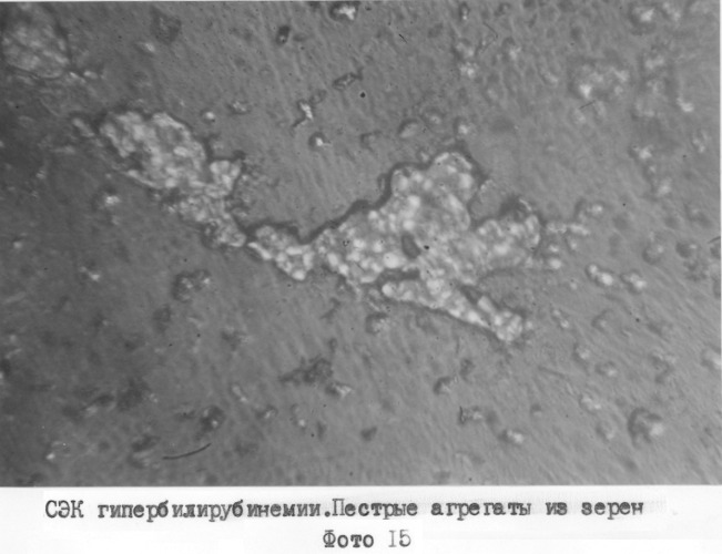 Способ экспресс-диагностики эндогенной интоксикации (патент 2280865)