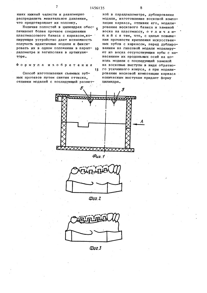 Способ изготовления съемных зубных протезов (патент 1456135)