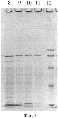 Способ получения протективного антигена и белка s-слоя ea1 из аспорогенного рекомбинантного штамма b. anthracis 55 тпа-1spo- (патент 2492241)