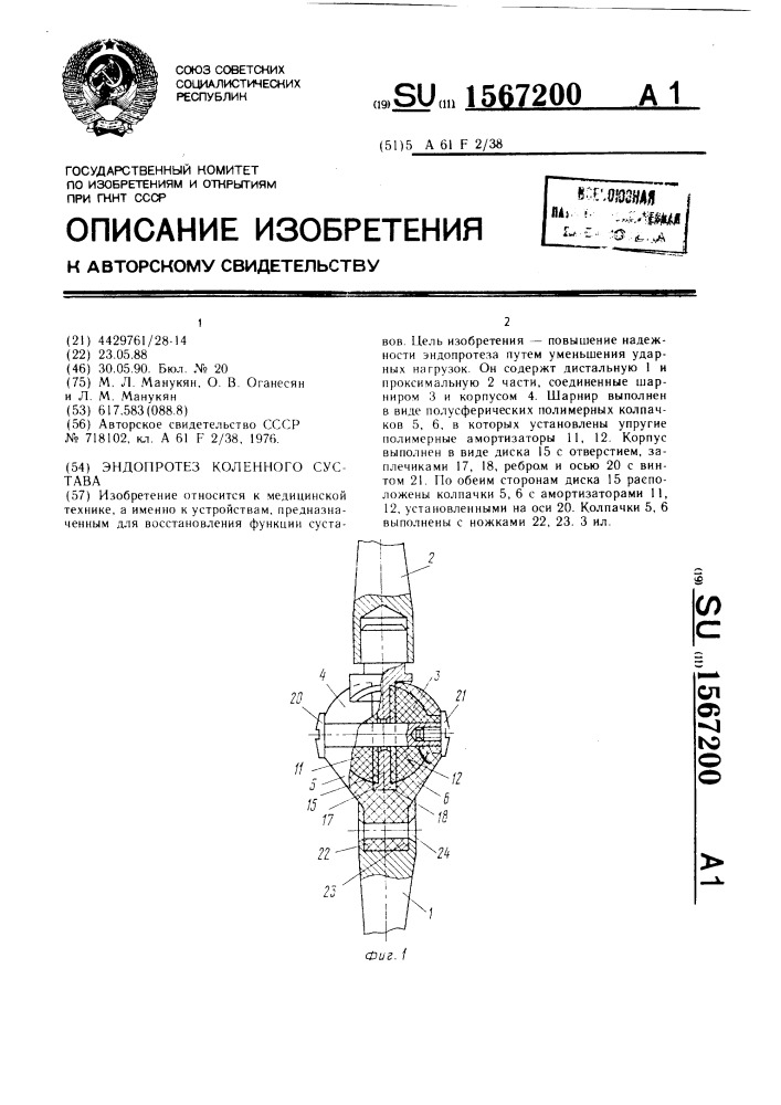 Эндопротез коленного сустава (патент 1567200)