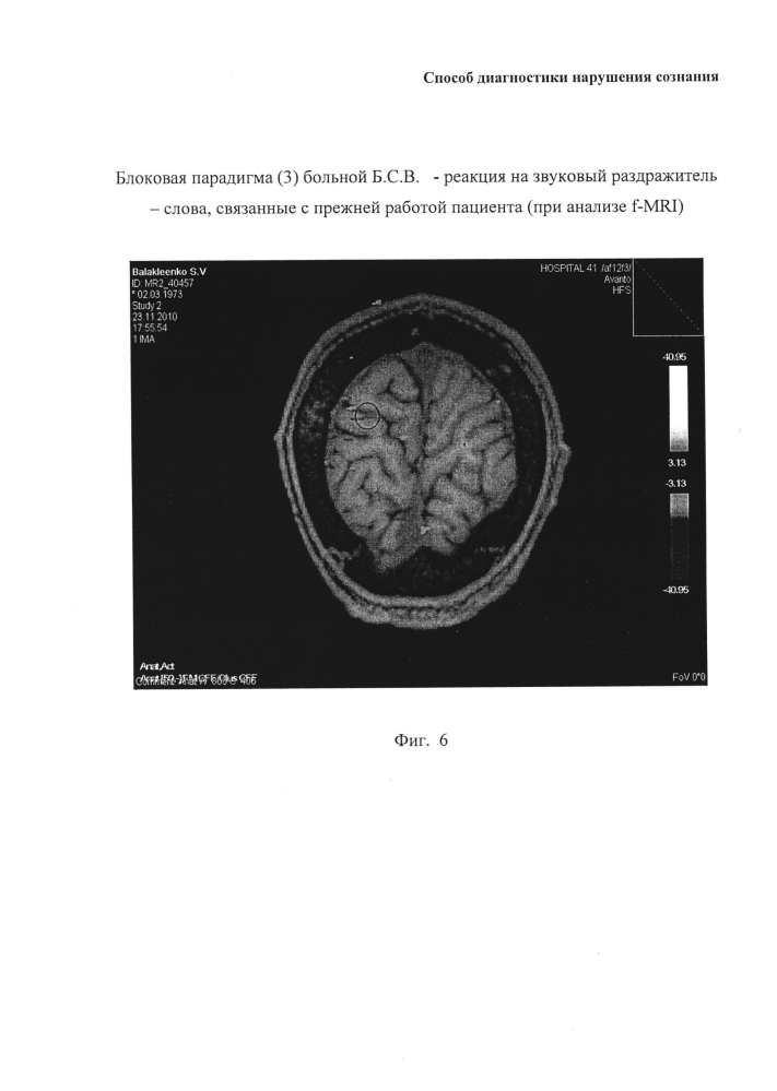 Способ диагностики нарушения сознания (патент 2596049)
