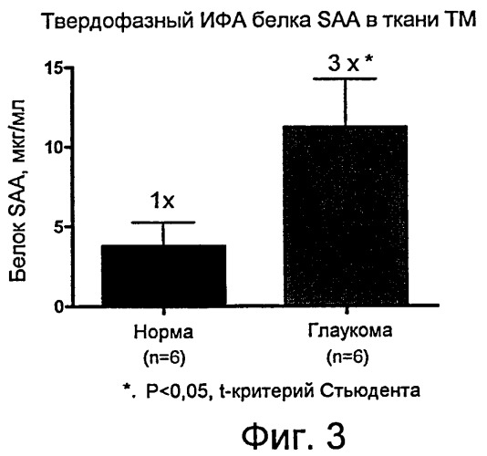 Применение гена сывороточного амилоида а для диагностики и лечения глаукомы и идентификации антиглаукомных агентов (патент 2461378)