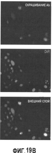 Вакцины на основе свиного вируса torque teno и способы диагностики инфекций, вызванных этим вирусом (патент 2553223)