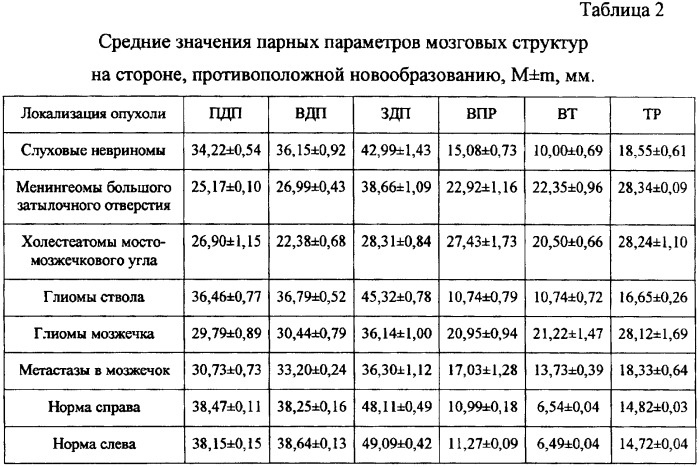 Способ диагностики опухолей задней черепной ямки (патент 2338466)