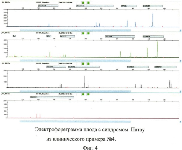 Способ пренатальной и постнатальной днк-диагностики синдрома дауна, эдвардса, патау, мутации delf508 в гене муковисцидоза и резус-фактора плода (патент 2539778)