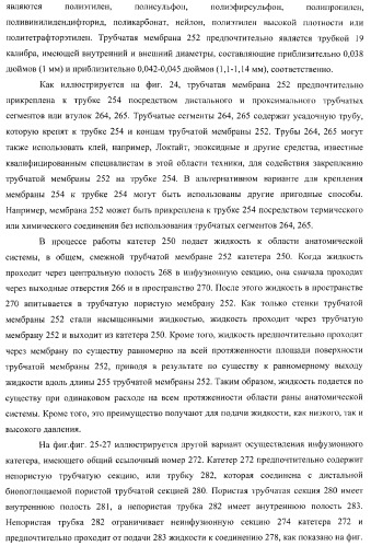 Катетер для равномерной подачи лекарственного средства (патент 2366465)