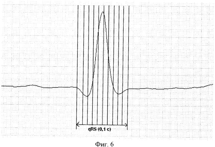 Способ выделения начала кардиоцикла (патент 2366358)