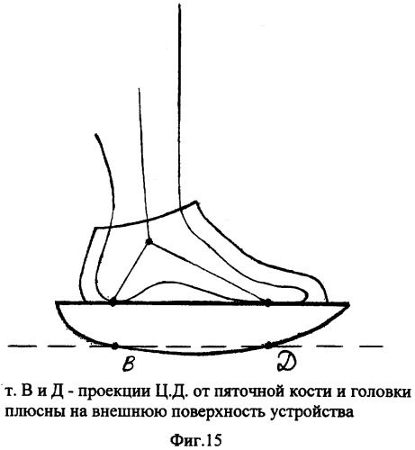 Способ и устройство для исправления дефектов стопы (патент 2301039)