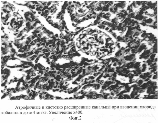 Способ моделирования хронической токсической нефропатии (патент 2255375)