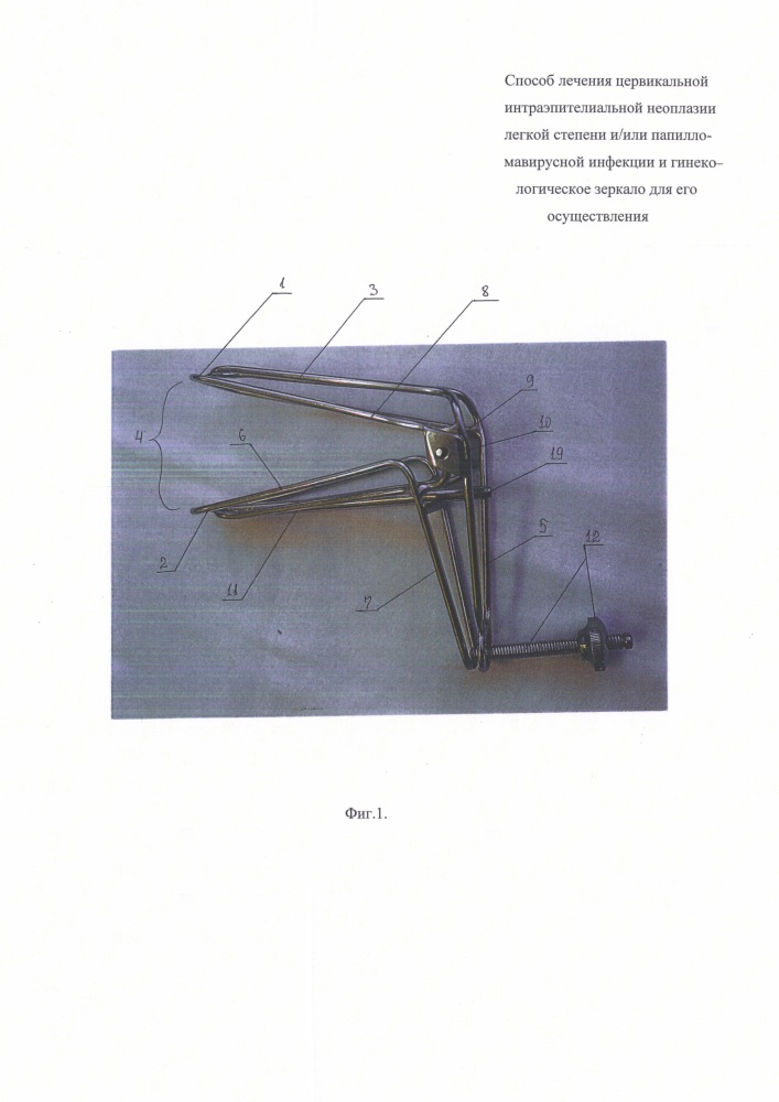 Способ лечения цервикальной интраэпителиальной неоплазии легкой степени и/или папилломавирусной инфекции и гинекологическое зеркало для его осуществления (патент 2623449)