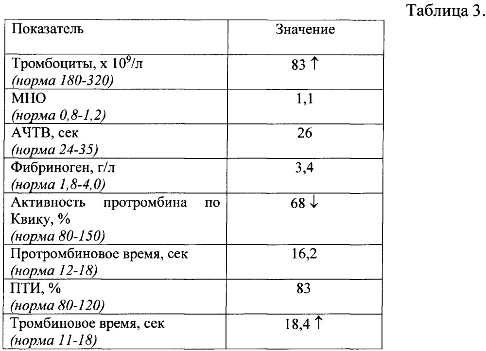 Способ определения риска развития гиперкоагуляции у больных с портальной гипертензией цирротического генеза после проведения портосистемного шунтирования (патент 2665118)