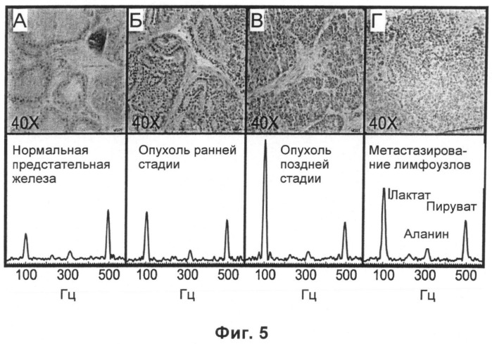 Магнитно-резонансные способы определения категории опухоли с использованием среды для визуализации, содержащей гиперполяризованный 13c-пируват (патент 2494672)