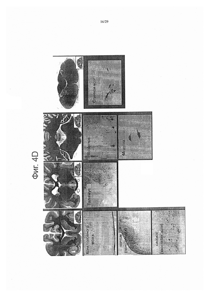 Способы и композиции для лечения болезней мозга (патент 2664471)