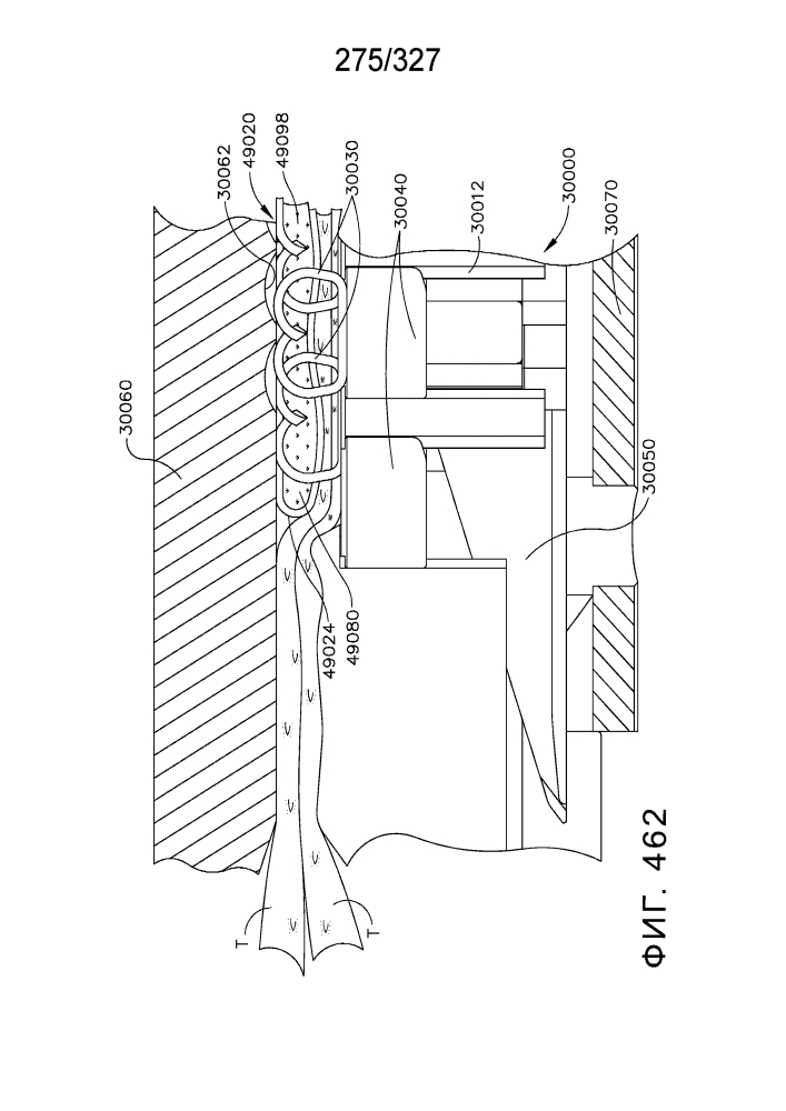 Компенсатор толщины ткани, содержащий капсулу для среды с низким давлением (патент 2639857)