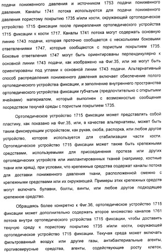 Способ лечения путем подкожной подачи пониженного давления с использованием разделения с помощью воздушного баллона (патент 2405588)