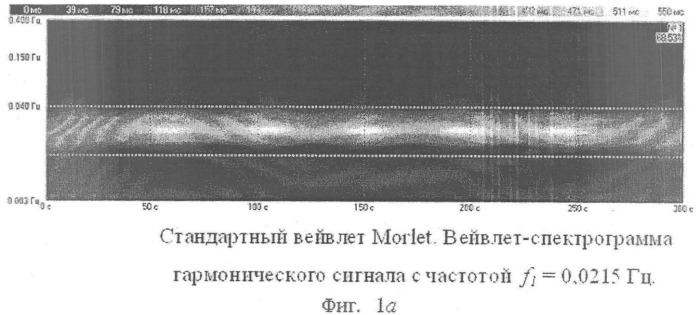 Способ анализа вариабельности сердечного ритма (патент 2356495)