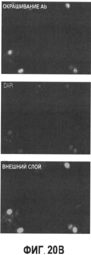 Вакцины на основе свиного вируса torque teno и способы диагностики инфекций, вызванных этим вирусом (патент 2553223)