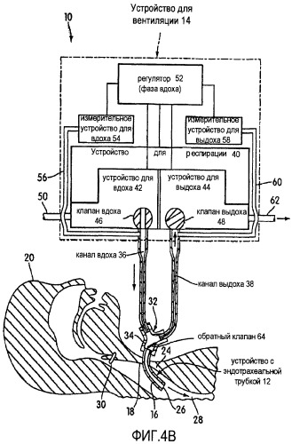Аппарат для вентиляции и способ, позволяющий пациенту говорить с обратным клапаном трахеостомической трубки или без него (патент 2455031)