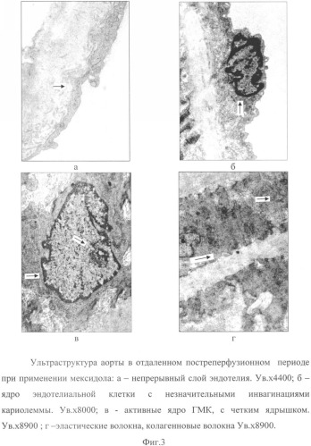 Способ коррекции структурных перестроек сосудов в эксперименте (патент 2349320)