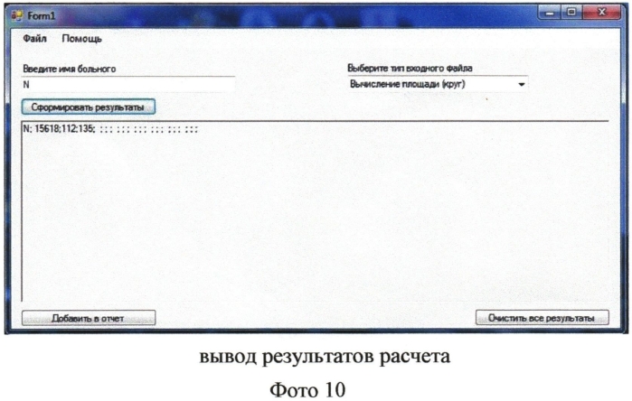 Способ динамического контроля за состоянием диска зрительного нерва при заболеваниях зрительного нерва. (патент 2556567)