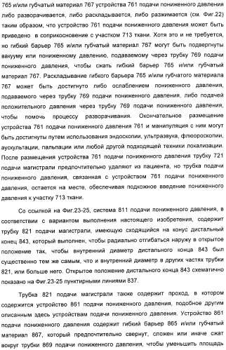 Способ лечения путем подкожной подачи пониженного давления с использованием разделения с помощью воздушного баллона (патент 2405588)