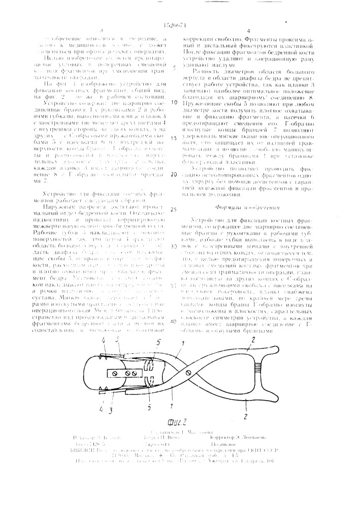 Устройство для фиксации костных фрагментов (патент 1526674)