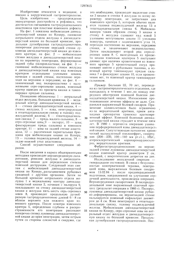 Способ лечения пенетрирующих пилородуоденальных язв (патент 1297815)