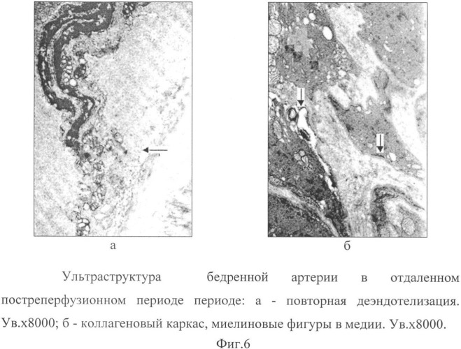 Способ коррекции структурных перестроек сосудов в эксперименте (патент 2349320)