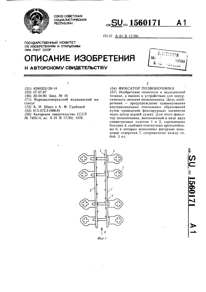Фиксатор позвоночника (патент 1560171)