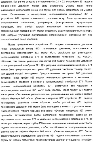 Способ лечения путем подкожной подачи пониженного давления с использованием разделения с помощью воздушного баллона (патент 2405588)