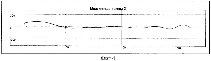 Способ определения типа демпинг-реакции при демпинг-синдроме (патент 2334456)