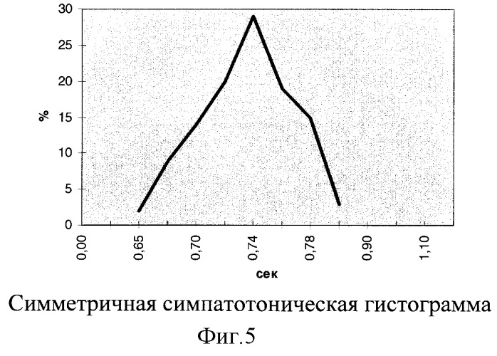 Способ оценки эффективности лечения у больных безболевой ишемией миокарда с различными типами вегетативной направленности (патент 2276574)