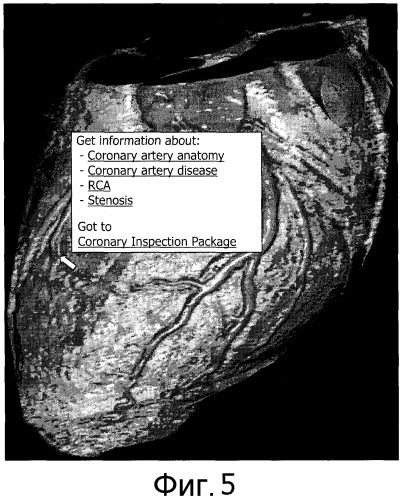 Приложения для эффективной диагностики, зависимые от изображения и контекста, относящиеся к анатомии (патент 2451335)