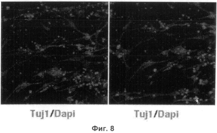 Конверсия соматических клеток в индуцированные репрограмированные нейрональные стволовые клетки (ирнск) (патент 2562111)