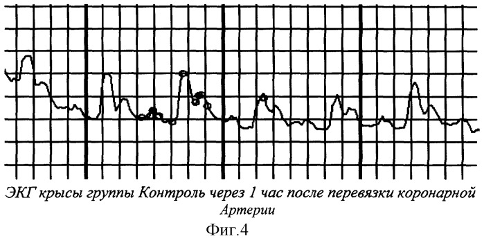 Коронароактивное антиишемическое и антиаритмическое средство (патент 2290927)