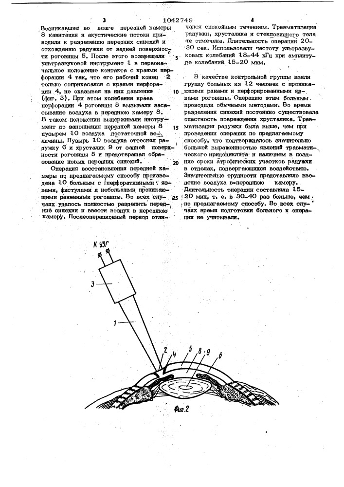 Способ восстановления передней камеры при перфорациях роговицы (патент 1042749)