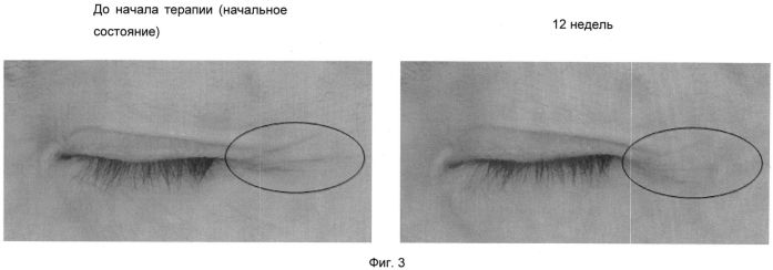 Способы получения косметической композиции из среды, получаемой после выклева икры salmonidae, и ее применения для улучшения косметического состояния кожи (патент 2558848)