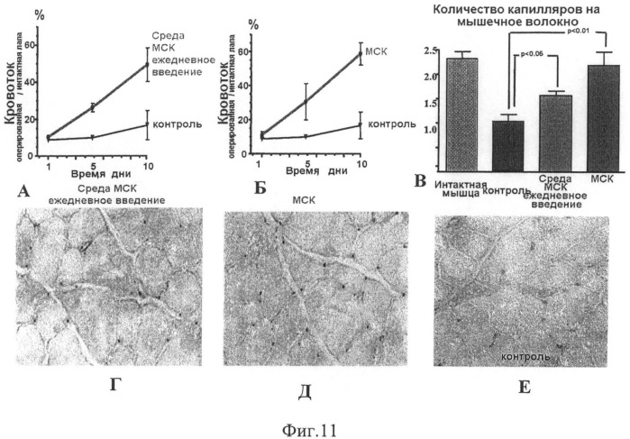 Способ стимуляции регенеративных процессов в ишемизированных тканях (патент 2497529)