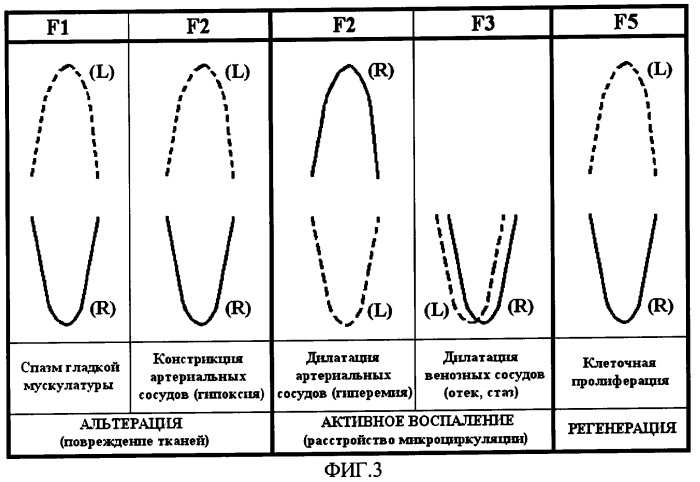 Способ диагностики состояния внутренних органов (патент 2321340)