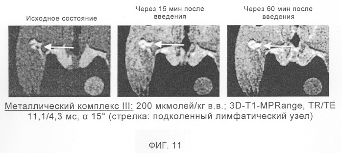 Применение перфторалкилсодержащих комплексов металлов в качестве контрастных веществ в магнитно-резонансной томографии для визуализации бляшек, опухолей и некрозов (патент 2290206)