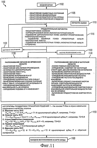 Способ позиционирования конца катетера (патент 2549998)