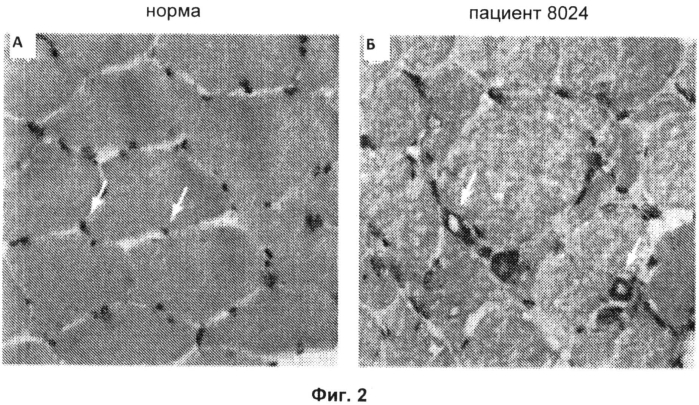 Композиции и способы характеризации миопатии (патент 2574932)