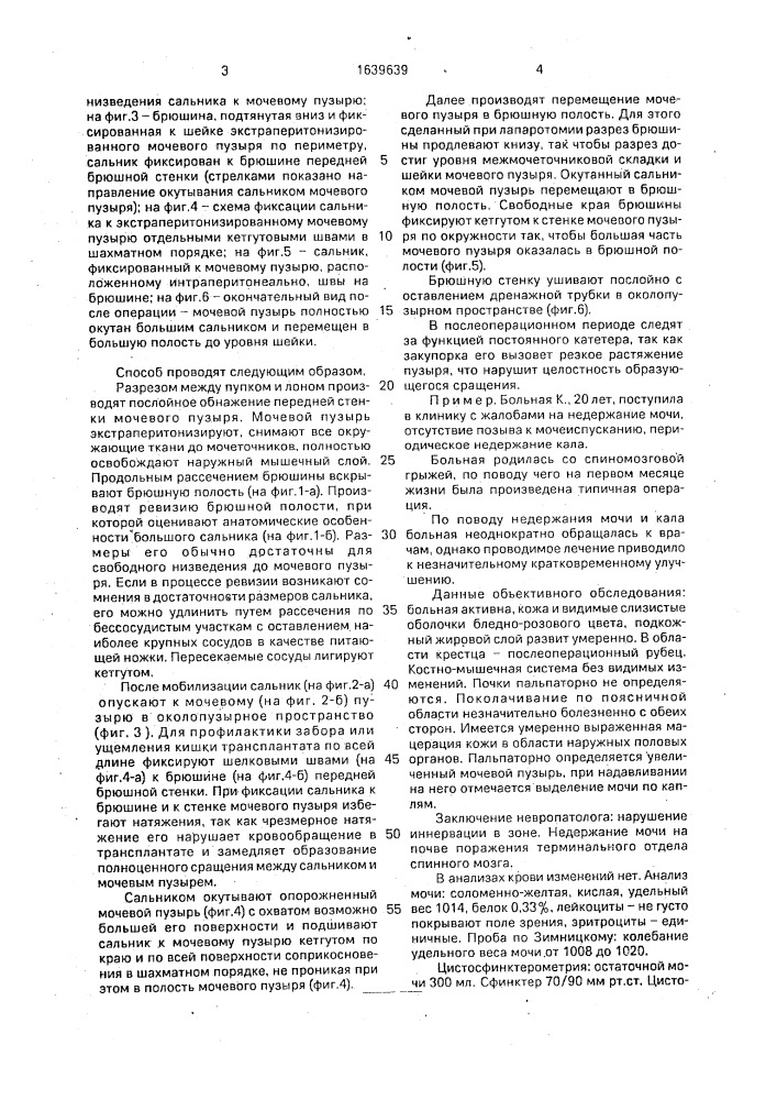 Способ хирургического лечения неврогенной дисфункции мочевого пузыря (патент 1639639)