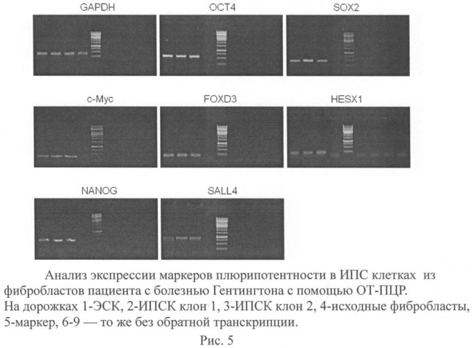 Способ получения индуцированных плюрипотентных стволовых клеток из фибробластов пациентов с болезнью хангингтона (патент 2458983)