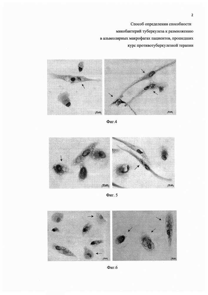 Способ определения способности микобактерий туберкулеза к размножению в альвеолярных макрофагах пациентов, прошедших курс противотуберкулезной терапии (патент 2652882)