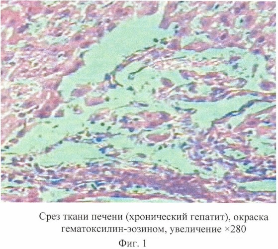 Средство &quot;гепатобиол&quot;, обладающее гепатопротекторным действием (патент 2429869)