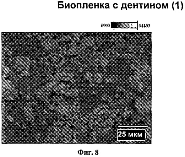 Реминерализация зубов (патент 2559592)