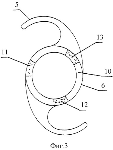 Искусственный хрусталик глаза (патент 2294174)