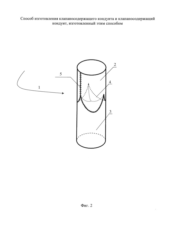Способ изготовления клапаносодержащего кондуита и клапаносодержащий кондуит, изготовленный этим способом (патент 2641171)