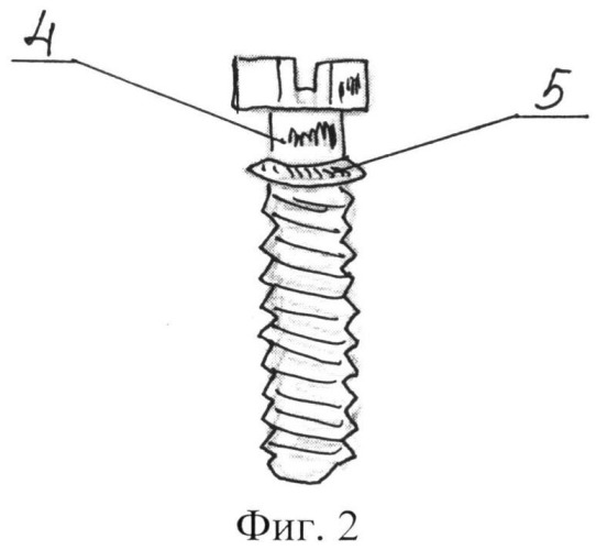 Имплантат для закрытия перфорационного отверстия гайморовой пазухи (патент 2519355)